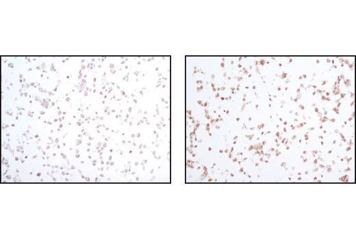  Image 3: PhosphoPlus® SAPK/JNK (Thr183/Tyr185) Antibody Duet