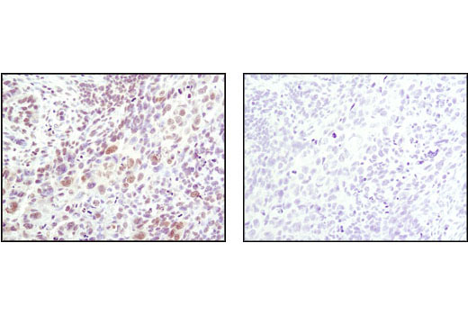 Immunohistochemistry Image 2: Phospho-SAPK/JNK (Thr183/Tyr185) (81E11) Rabbit mAb
