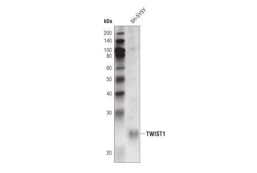 Western Blotting Image 1: TWIST1 Antibody