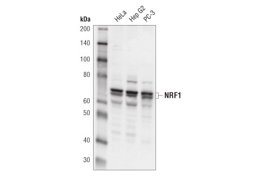 Recombinant Anti-ROR alpha/RORA antibody [EPR23719-18] (ab256799)