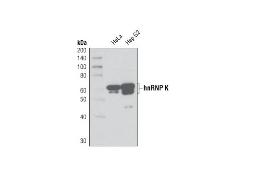 Western Blotting Image 1: hnRNP K (R332) Antibody