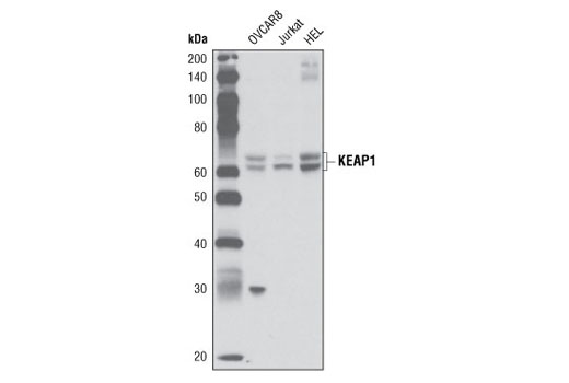 Western Blotting Image 1: KEAP1 (P586) Antibody