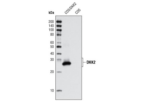 Western Blotting Image 1: DKK2 (G44) Antibody