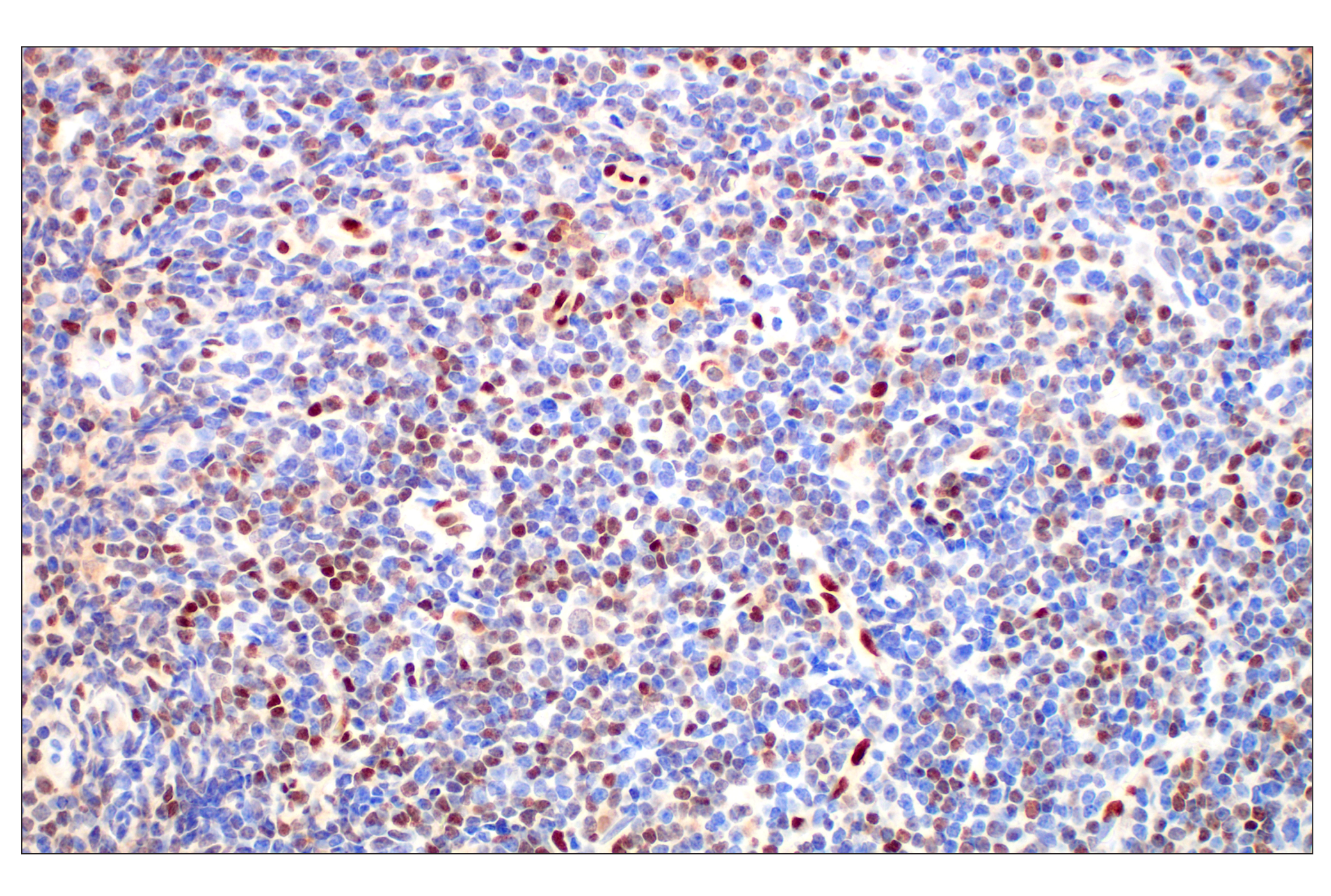 Immunohistochemistry Image 3: Basic FGF (E5Y6M) Rabbit mAb