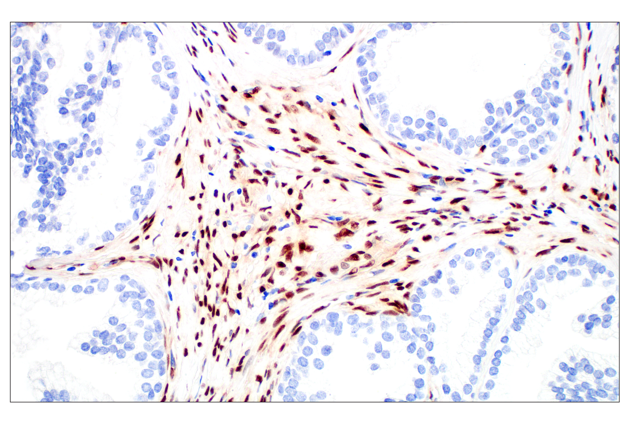 Immunohistochemistry Image 6: Basic FGF (E5Y6M) Rabbit mAb
