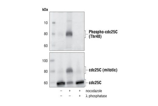  Image 5: cdc25C Antibody Sampler Kit