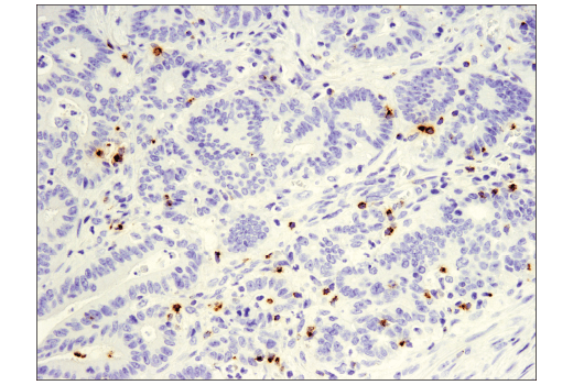 Immunohistochemistry Image 1: Granzyme B (D6E9W) Rabbit mAb