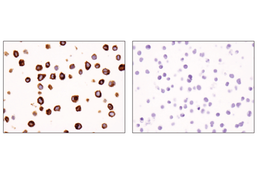  Image 57: Human Exhausted CD8+ T Cell IHC Antibody Sampler Kit