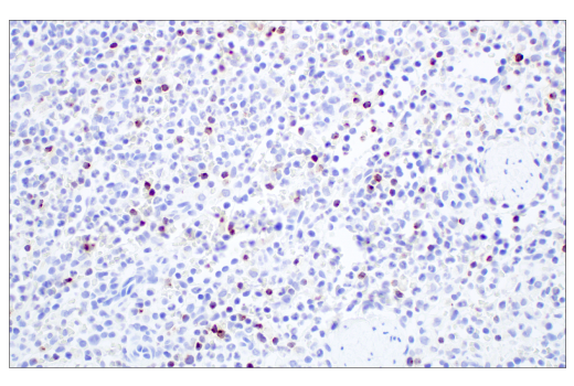  Image 3: Human Exhausted CD8+ T Cell IHC Antibody Sampler Kit