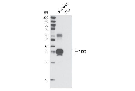 Western Blotting Image 1: DKK2 (N70) Antibody