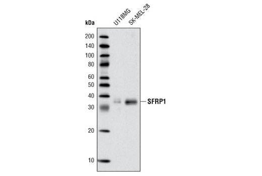 Western Blotting Image 1: SFRP1 Antibody