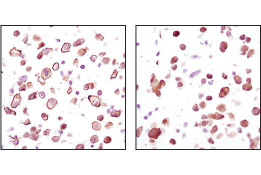  Image 30: PDGF Receptor Activation Antibody Sampler Kit