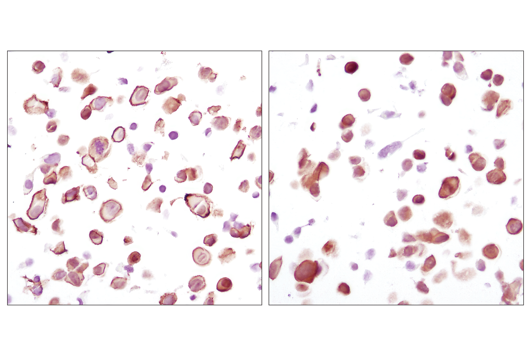  Image 19: AS160 Signaling Antibody Sampler Kit