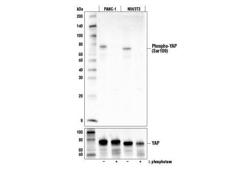 Western Blotting Image 1: Phospho-YAP (Ser109) Antibody