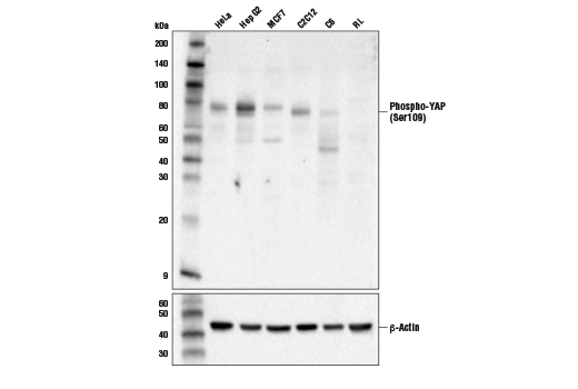 Western Blotting Image 2: Phospho-YAP (Ser109) Antibody