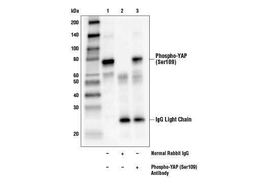 Immunoprecipitation Image 1: Phospho-YAP (Ser109) Antibody