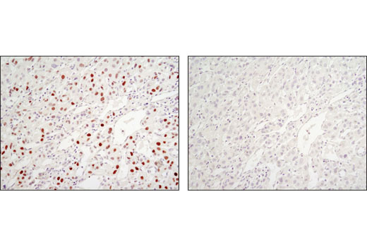 Immunohistochemistry Image 3: C/EBPα (D56F10) XP® Rabbit mAb (BSA and Azide Free)