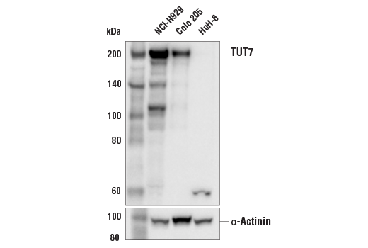 Western Blotting Image 1: TUT7 Antibody