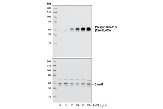  Image 3: Human BMP-2 Recombinant Protein
