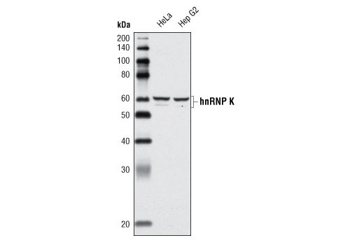 Western Blotting Image 1: hnRNP K (A222) Antibody