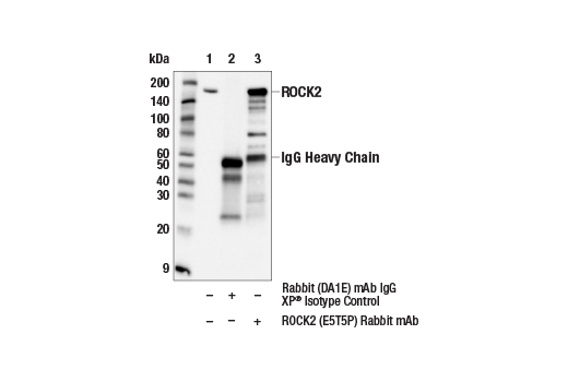 Immunoprecipitation Image 1: ROCK2 (E5T5P) Rabbit mAb