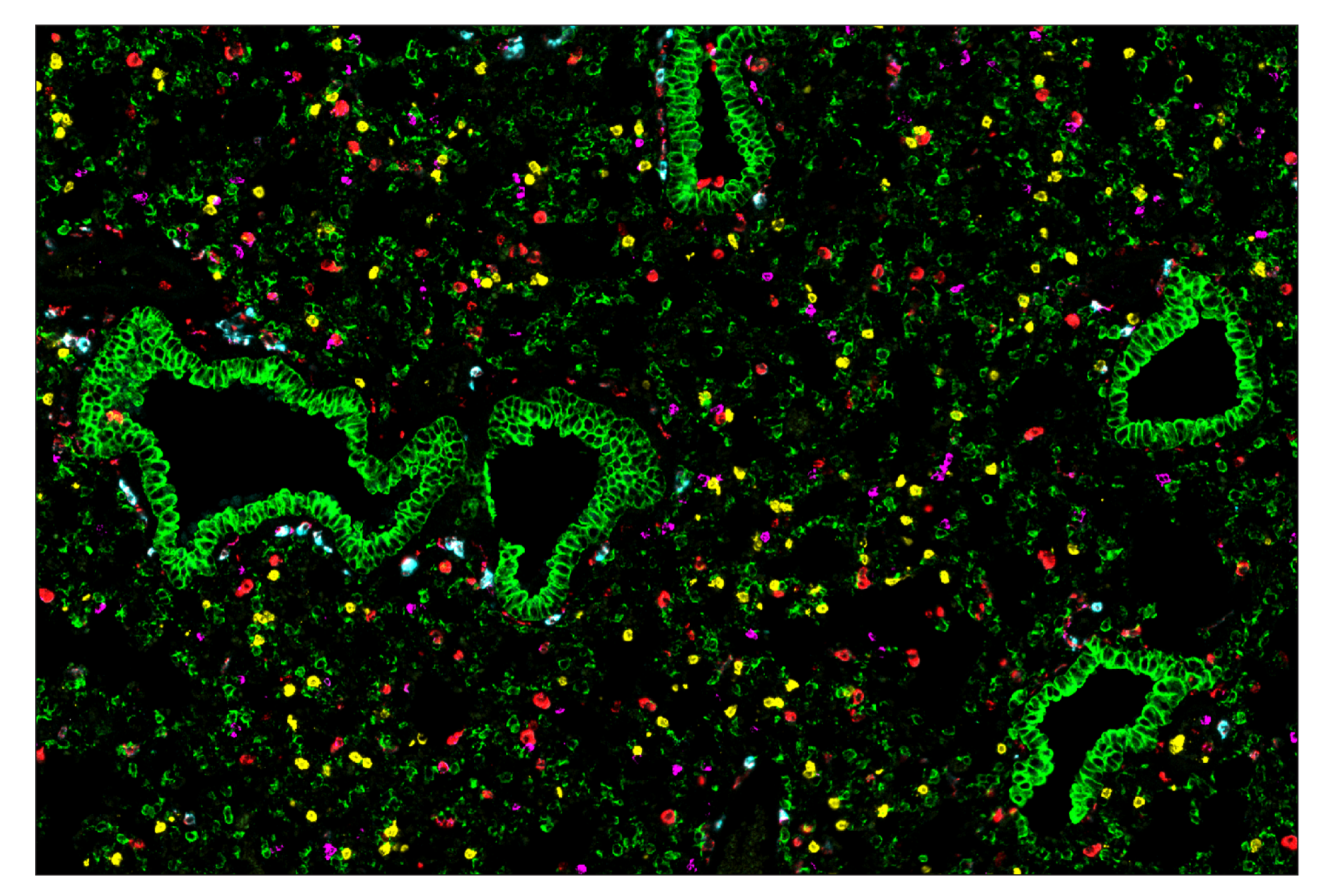 Immunohistochemistry Image 7: CD68 (E3O7V) & CO-0096-488 SignalStar™ Oligo-Antibody Pair