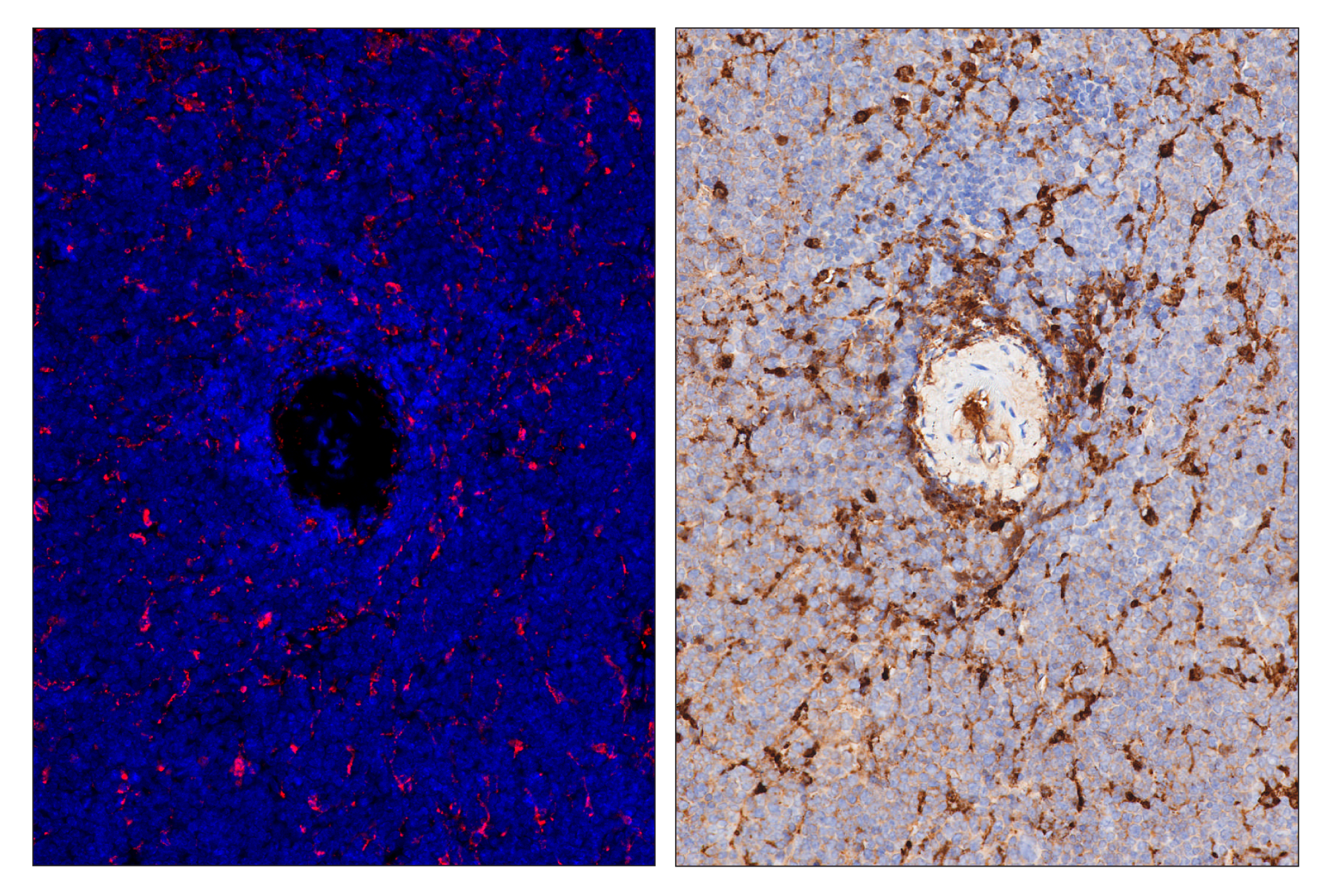 Immunohistochemistry Image 6: CD68 (E3O7V) & CO-0096-488 SignalStar™ Oligo-Antibody Pair