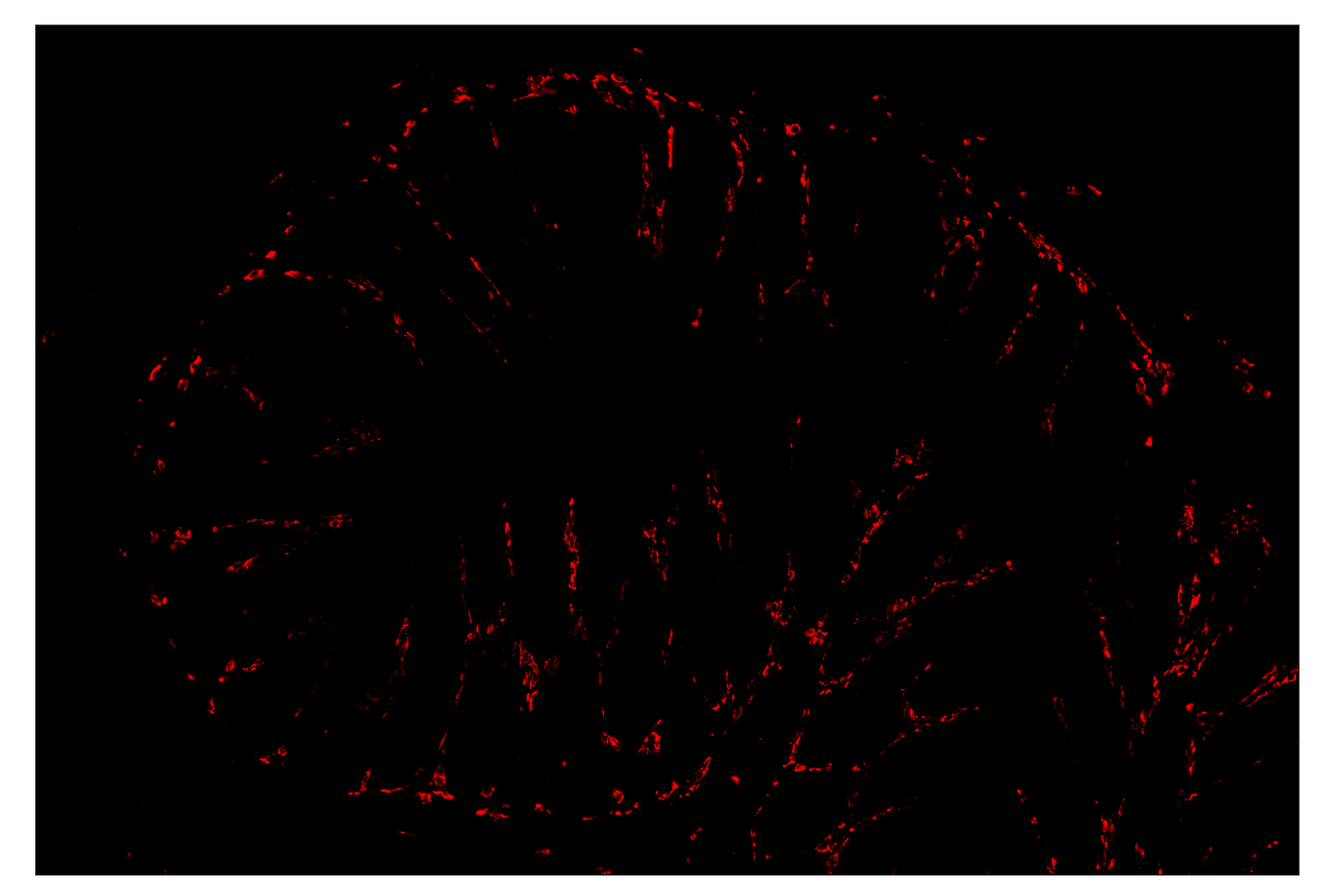 Immunohistochemistry Image 4: CD68 (E3O7V) & CO-0096-488 SignalStar™ Oligo-Antibody Pair