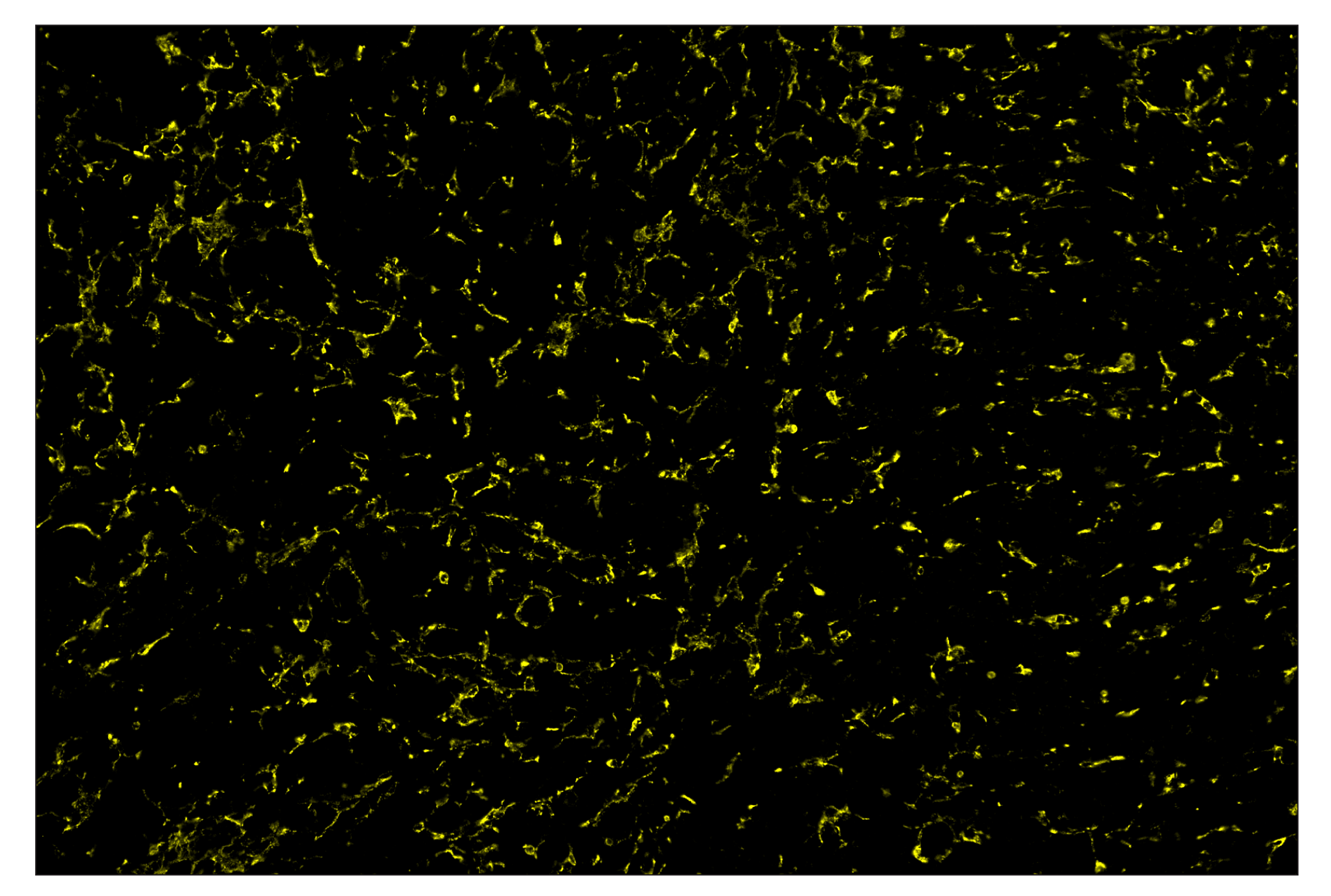 Immunohistochemistry Image 3: CD68 (E3O7V) & CO-0096-488 SignalStar™ Oligo-Antibody Pair