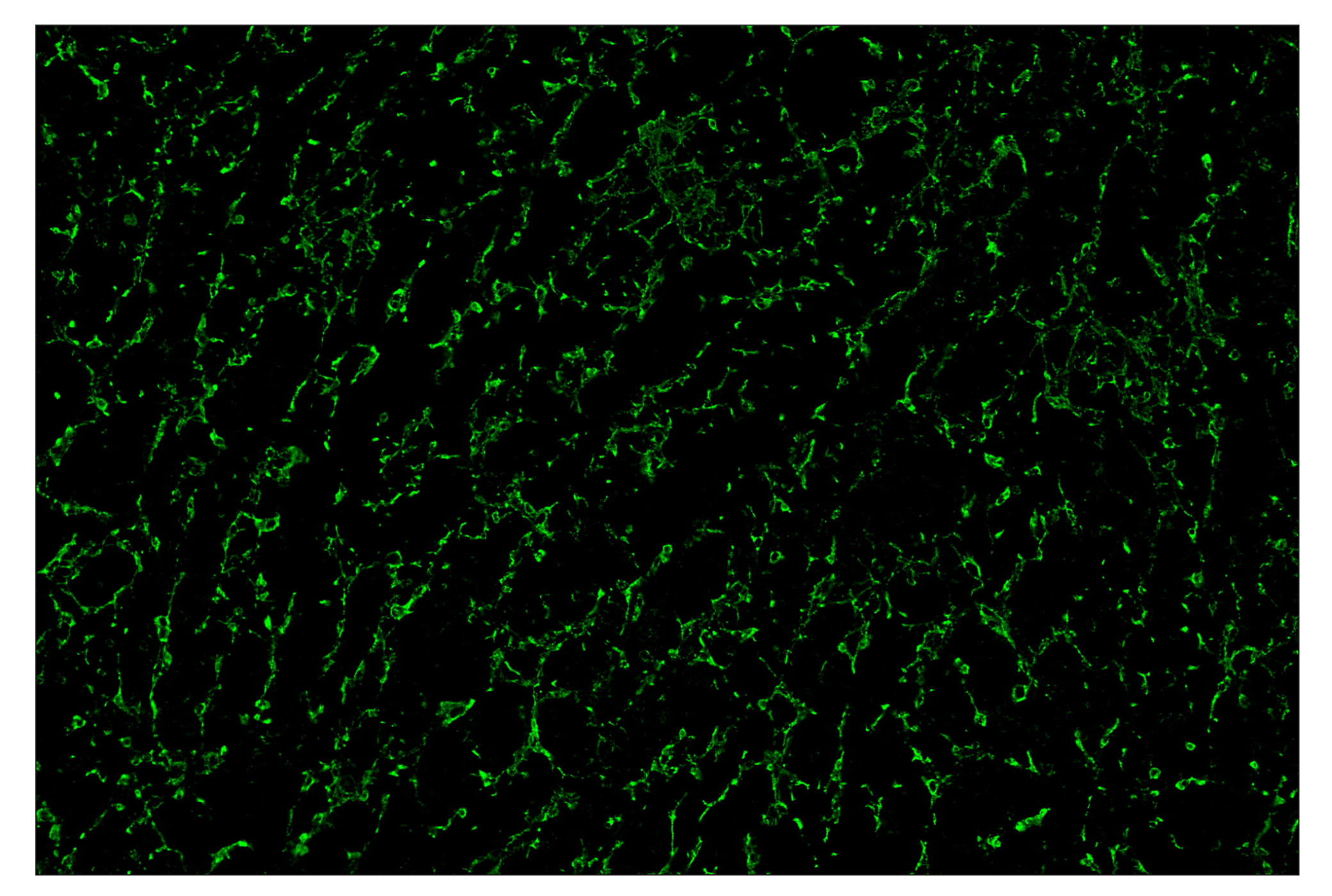 Immunohistochemistry Image 2: CD68 (E3O7V) & CO-0096-488 SignalStar™ Oligo-Antibody Pair