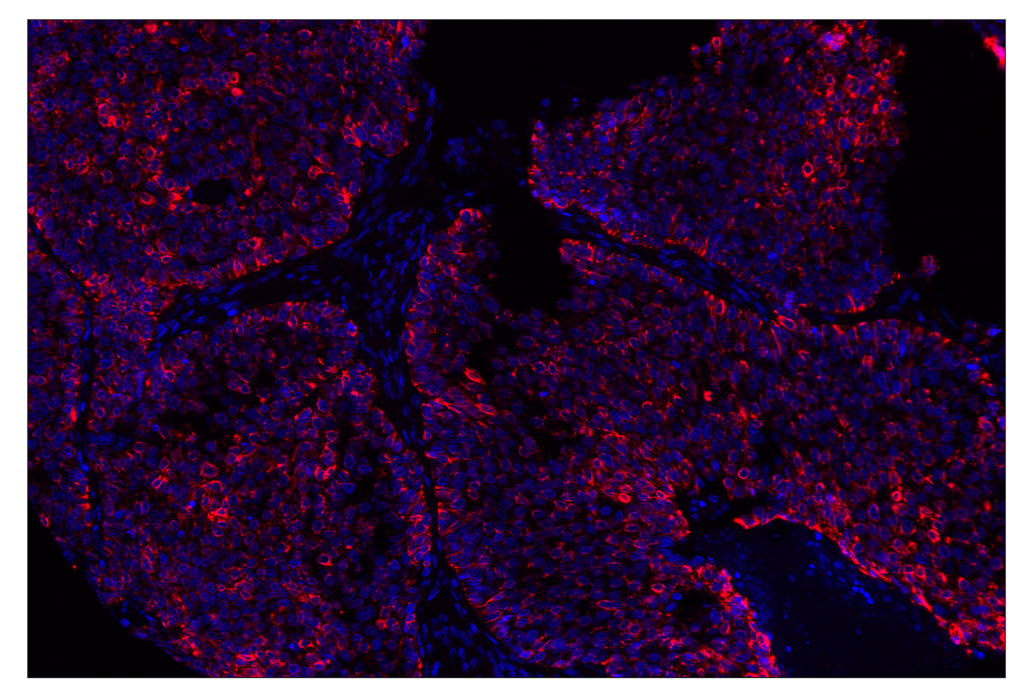 Immunohistochemistry Image 2: Keratin 5 (E2T4B) XP® Rabbit mAb (Alexa Fluor® 647 Conjugate)