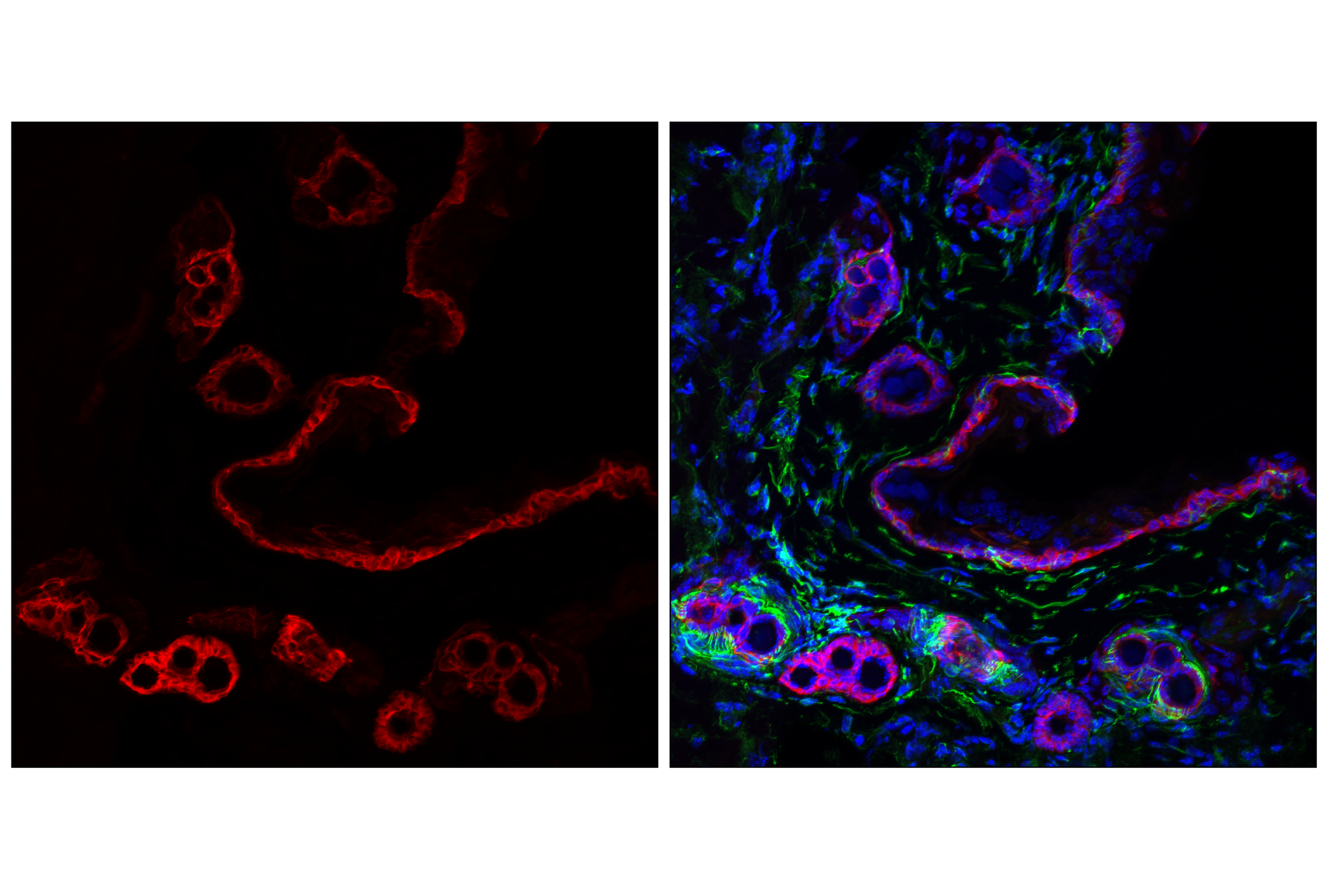 Immunofluorescence Image 1: Keratin 5 (E2T4B) XP® Rabbit mAb (Alexa Fluor® 647 Conjugate)