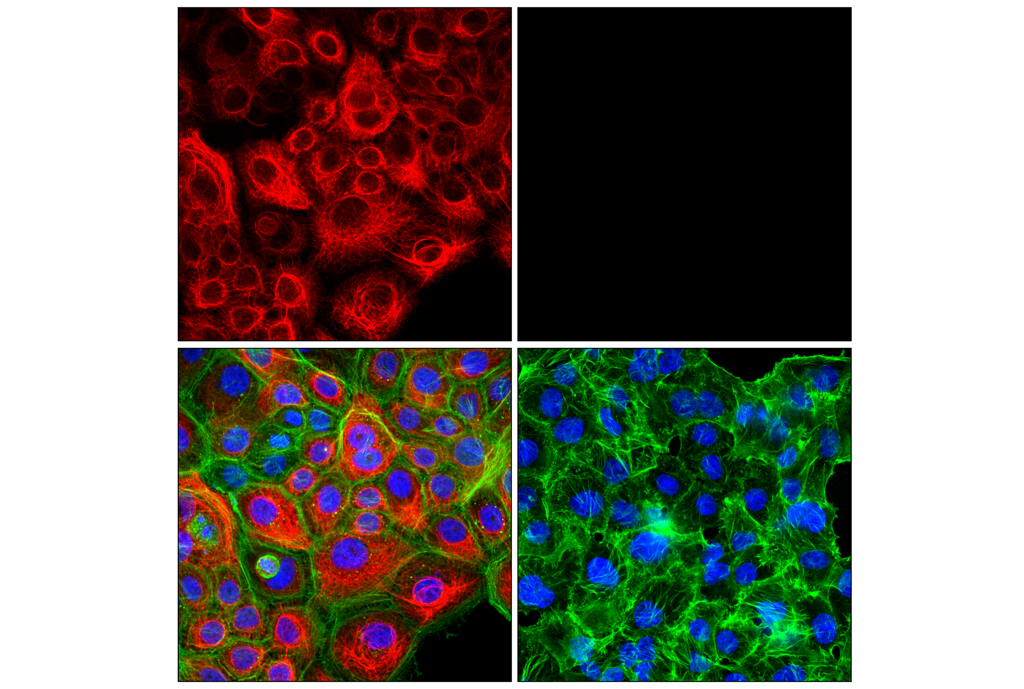 Immunofluorescence Image 2: Keratin 5 (E2T4B) XP® Rabbit mAb (Alexa Fluor® 647 Conjugate)