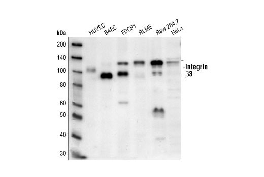 Western Blotting Image 1: Integrin β3 Antibody