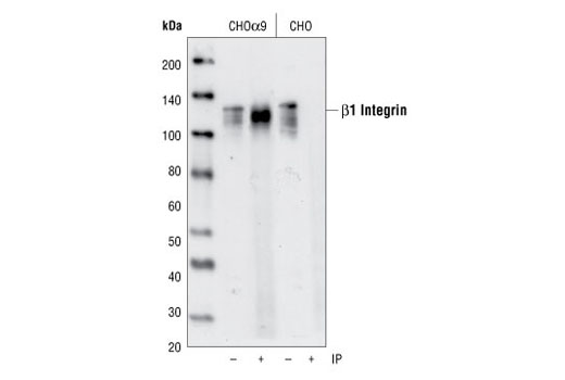 Immunoprecipitation Image 1: Integrin α9β1 (Y9A2) Mouse mAb
