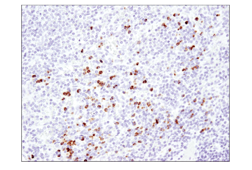 Immunohistochemistry Image 2: YKL-40 (E2L1M) Rabbit mAb