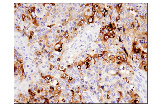 Immunohistochemistry Image 3: YKL-40 (E2L1M) Rabbit mAb