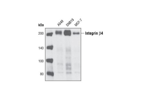 Western Blotting Image 1: Integrin β4 Antibody