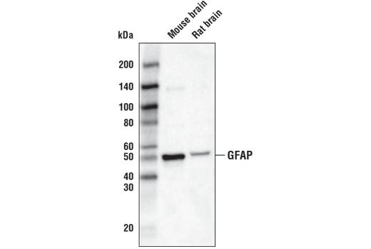 Western Blotting Image 1: GFAP (D1F4Q) XP® Rabbit mAb (Biotinylated)