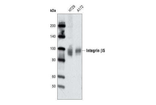 Western Blotting Image 1: Integrin β5 Antibody