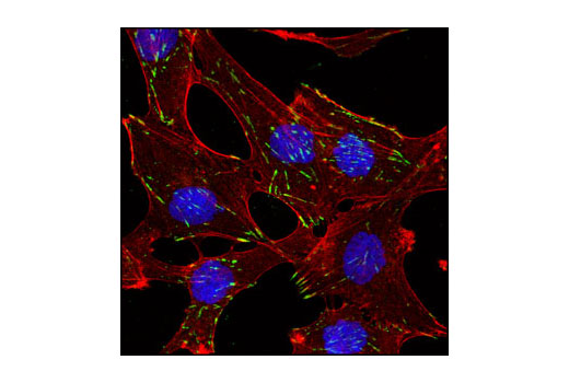 Immunofluorescence Image 1: Integrin β5 Antibody
