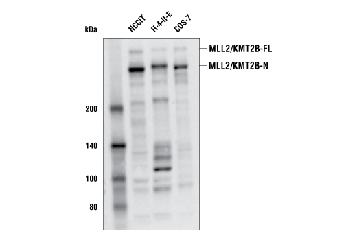 Western Blotting Image 2: MLL2/KMT2B (E3M1V) Rabbit mAb (Amino-terminal Antigen)