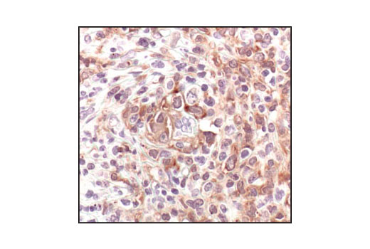 Immunohistochemistry Image 1: TRAF1 (1F3) Rat mAb
