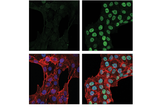 Immunofluorescence Image 1: XBP-1s (E7M5C) Mouse mAb