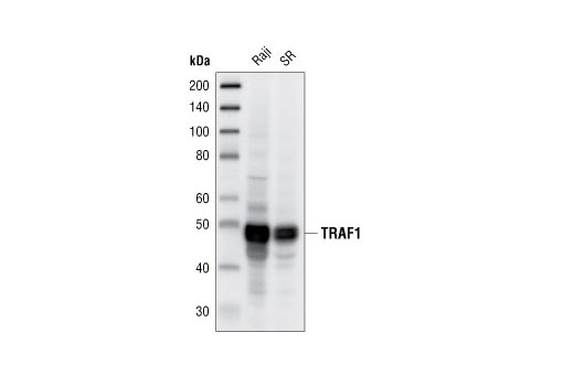  Image 1: TRAF Antibody Sampler Kit