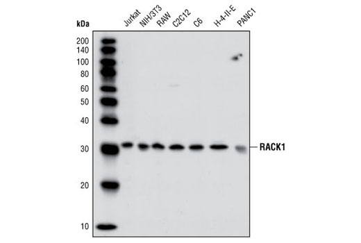 Western Blotting Image 1: RACK1 Antibody