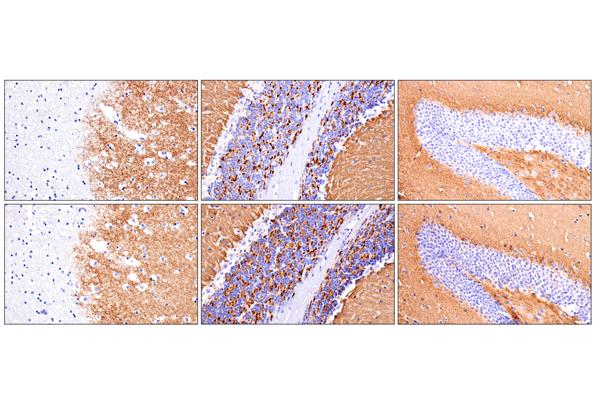 Immunohistochemistry Image 5: VGLUT1 (E8L5B) Rabbit mAb
