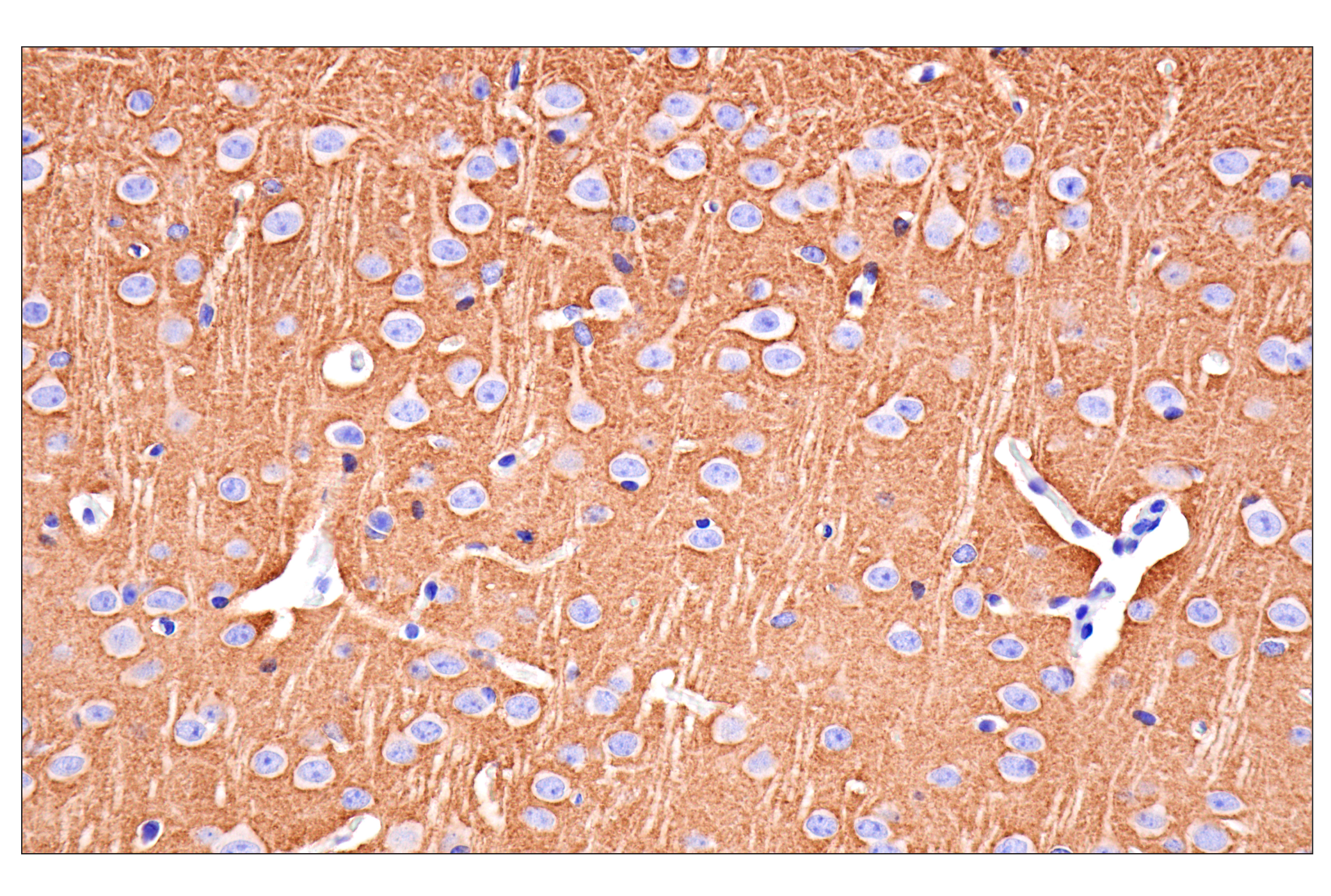  Image 15: Functional Neuron Marker Antibody Sampler Kit