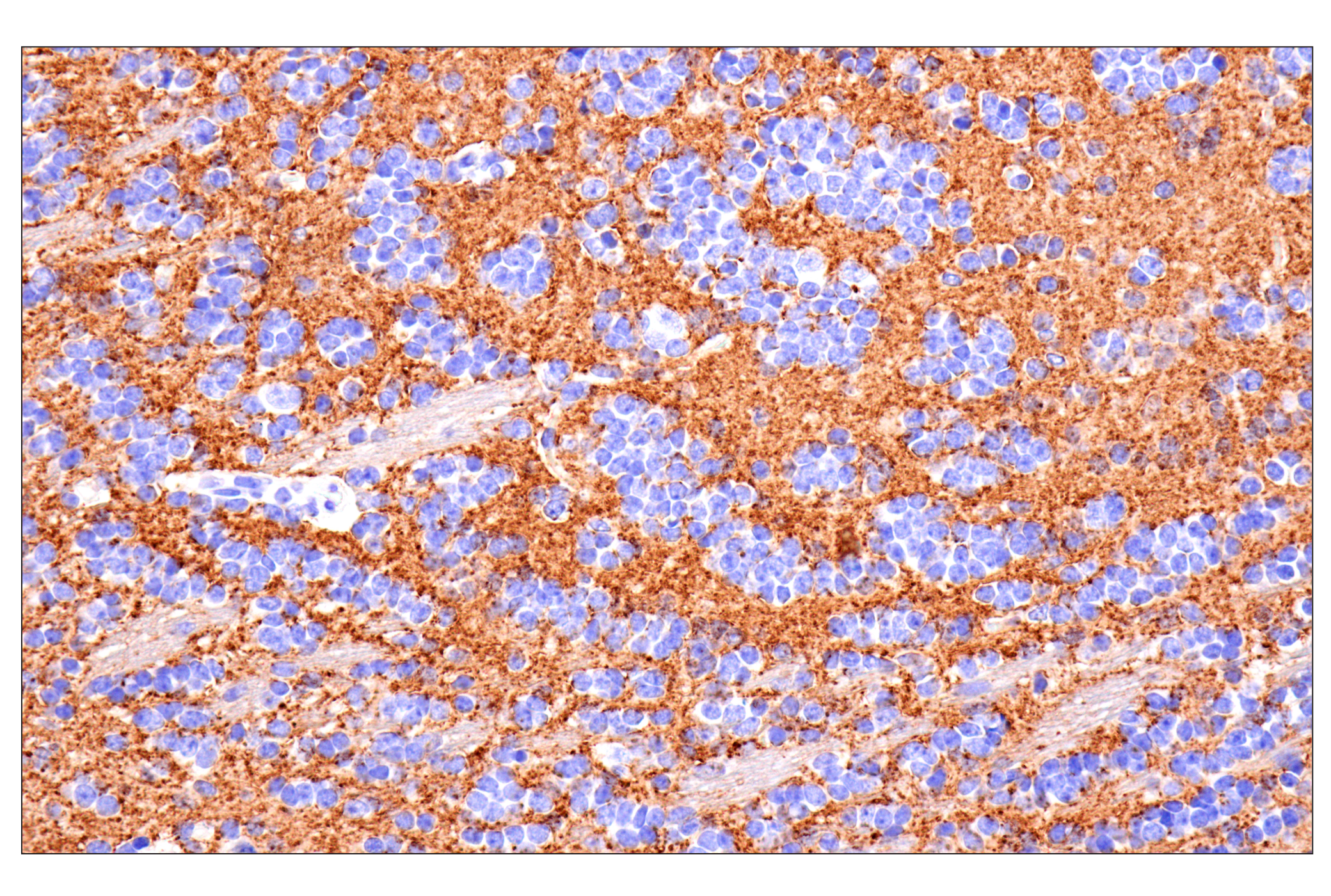 Immunohistochemistry Image 1: VGLUT1 (E8L5B) Rabbit mAb