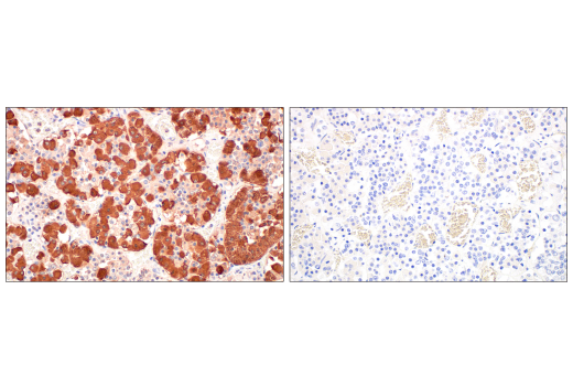 Immunohistochemistry Image 3: POMC (AH26) Mouse mAb